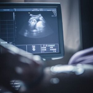 PEDIATRIC ULTRASOUND BASICS